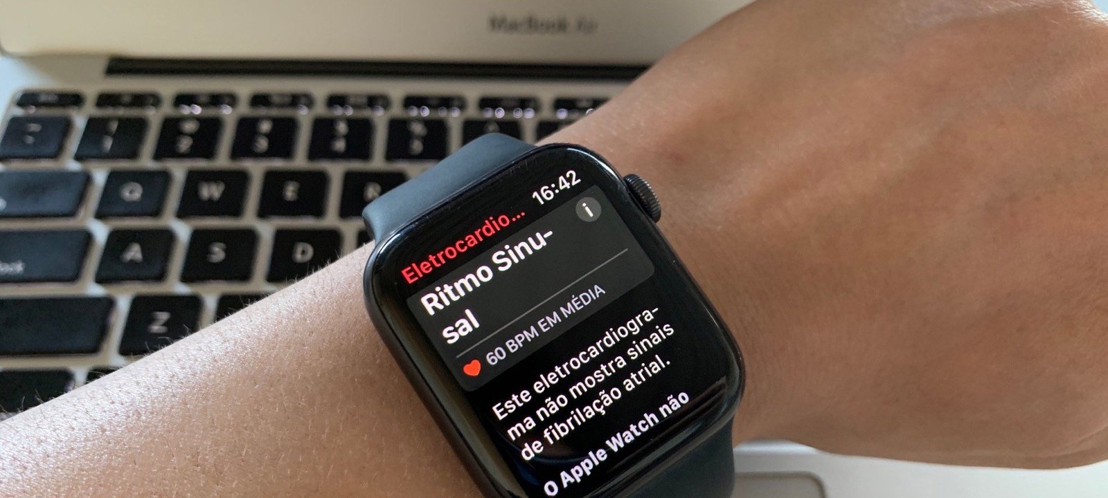 Seis smartwatches com ECG que ajudam a monitorar o coração: preços, recursos e limitações - Imagem do artigo