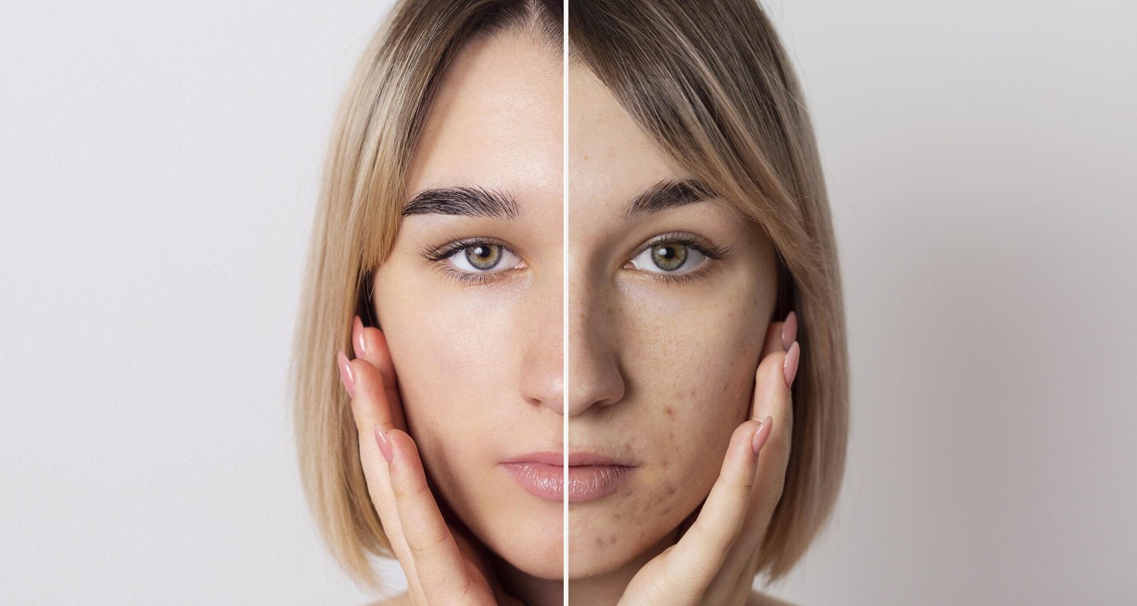 Celular, acne e envelhecimento: como o uso prolongado do aparelho impacta a saúde da pele - Imagem do artigo